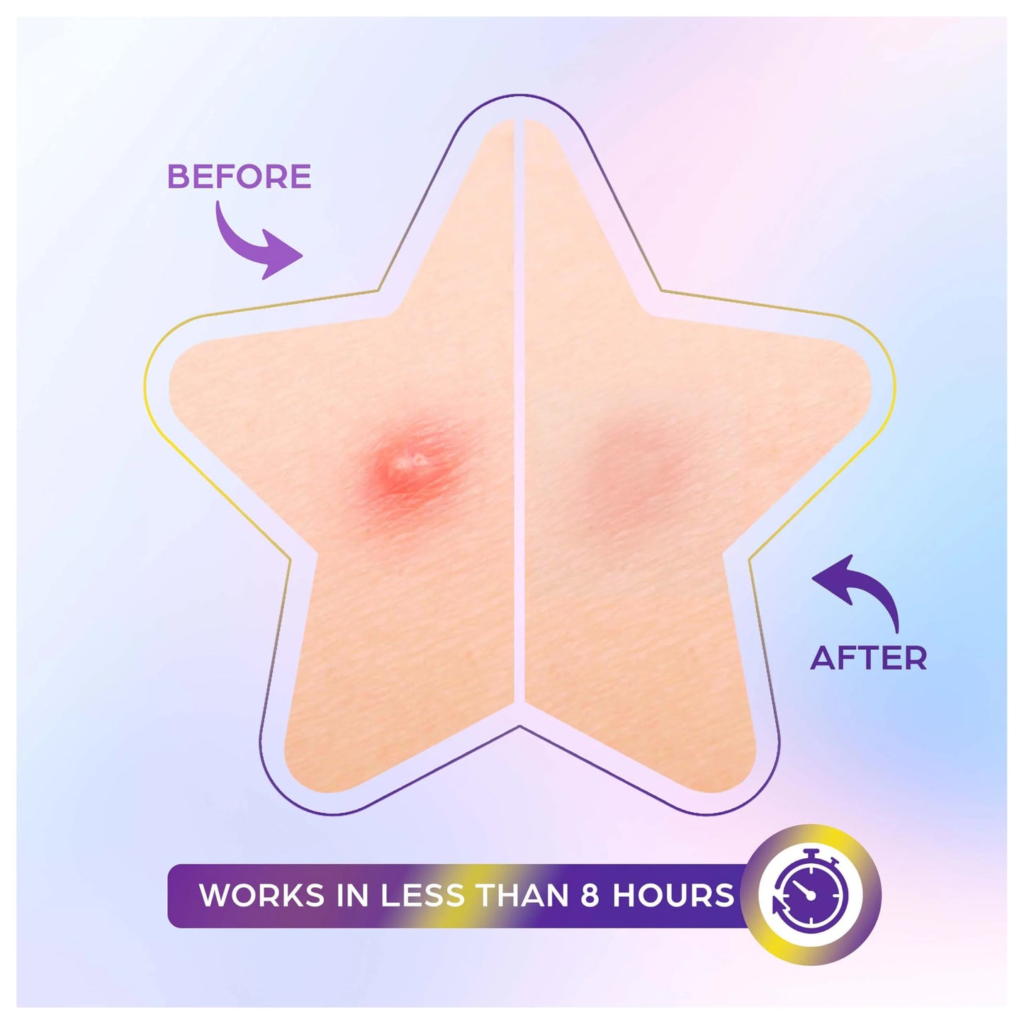 OOTD Hydrocolloid Star Spot Patch 80ks - Hvězdičkové náplasti na akné