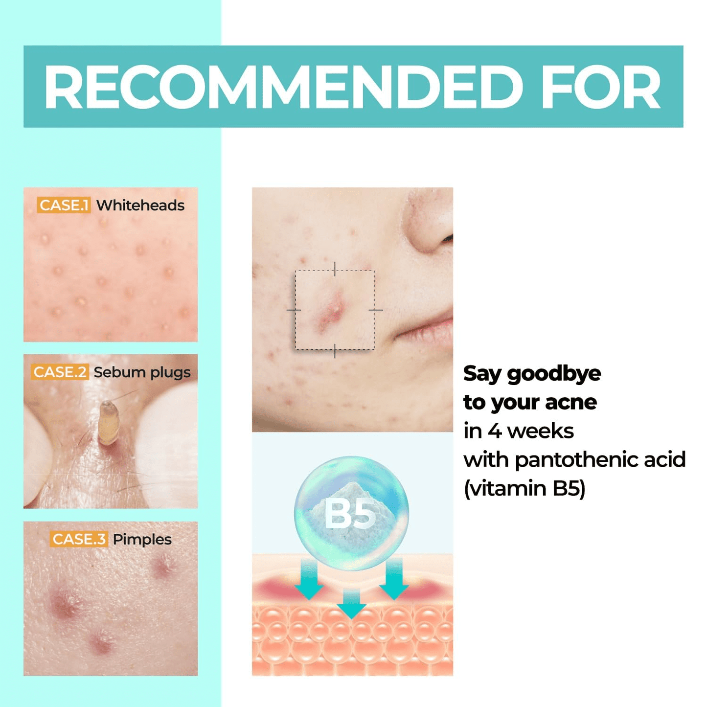 NUMBUZIN No.1 Pantothenic B5 Active Soothing Cream 80ml - Zklidňující pleťový krém s panthenolem