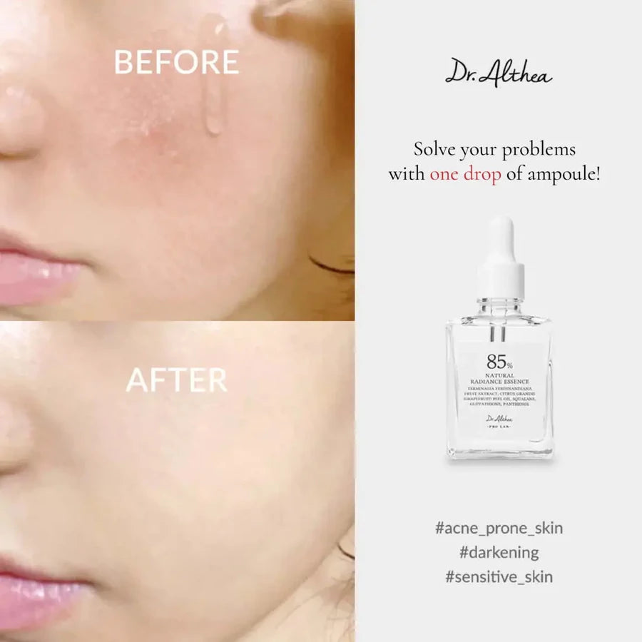 Dr. Althea Natural Radiance Essence 30ML -Rozjasňující esence na obličej
