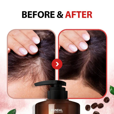 KUNDAL Natural Caffeine Hair Care+ (Cherry Blossom) 500ml- šampón proti vypadávání vlasů s kofeinem